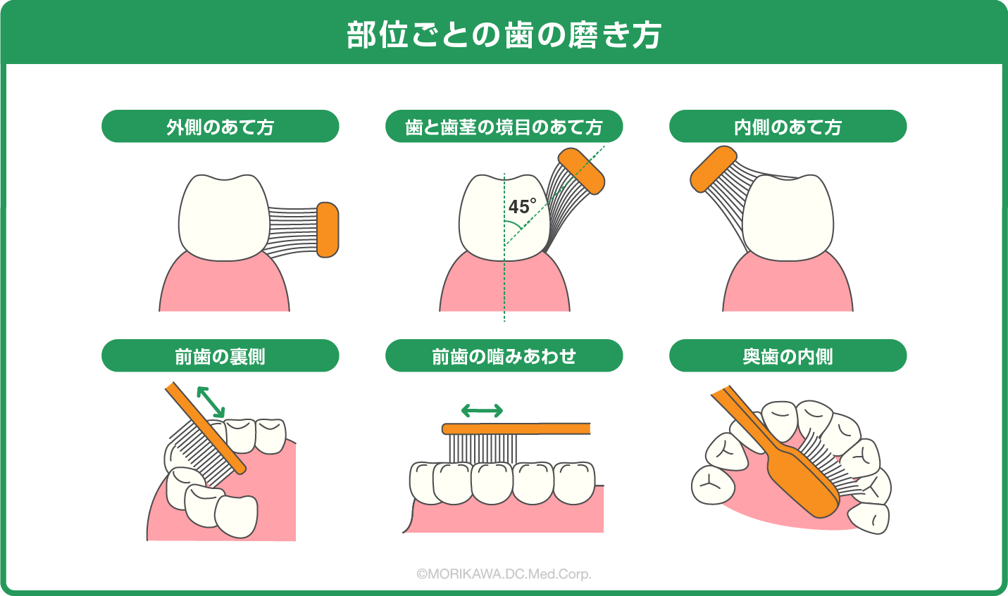 八尾市　歯医者　部位ごとの歯の磨き方