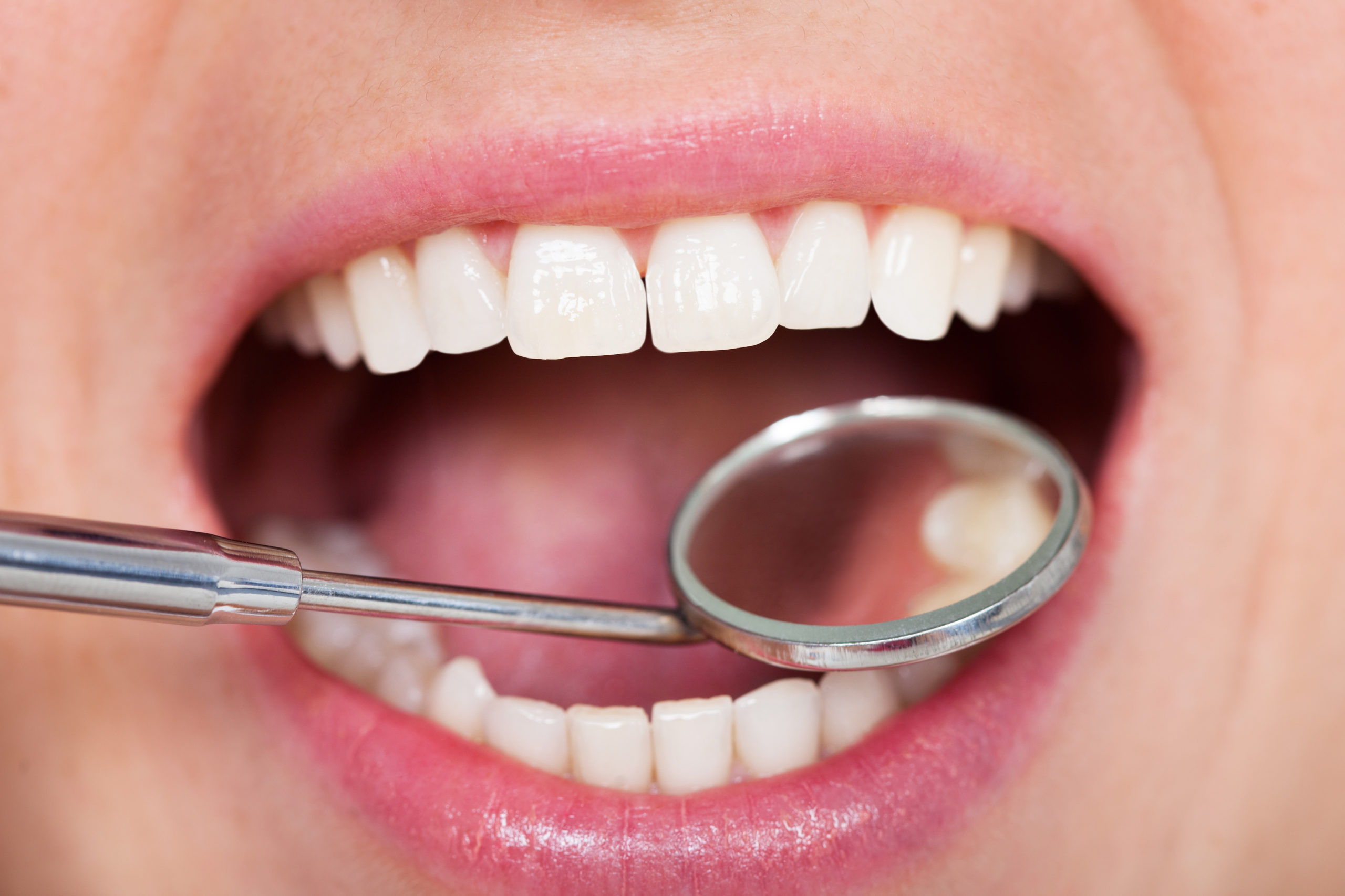 口を大きく開いて歯科用器具を用いて歯を確認する