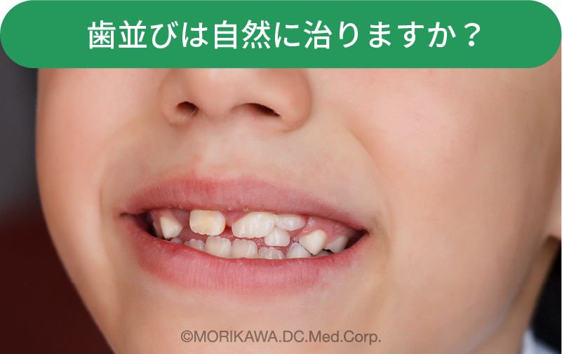 歯並びは自然に治りますか？