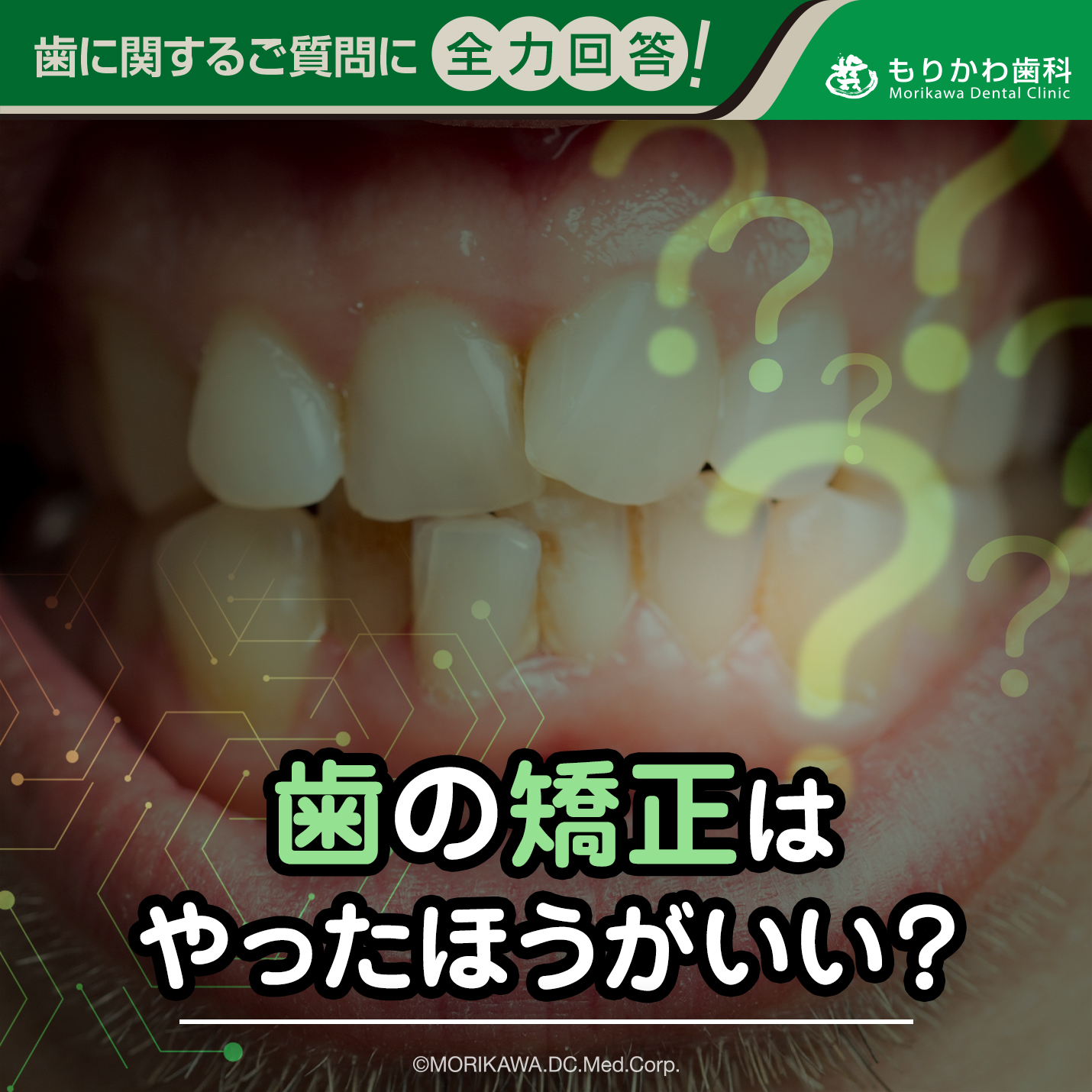歯の矯正はやったほうがいい？