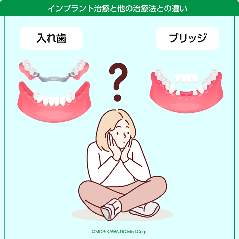 インプラント治療と他の治療法との違い