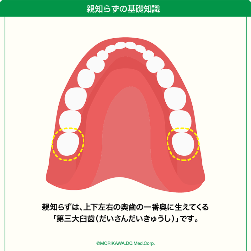 親知らずの基礎知識