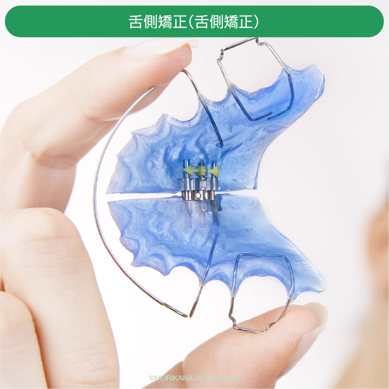 裏側矯正（舌側矯正）