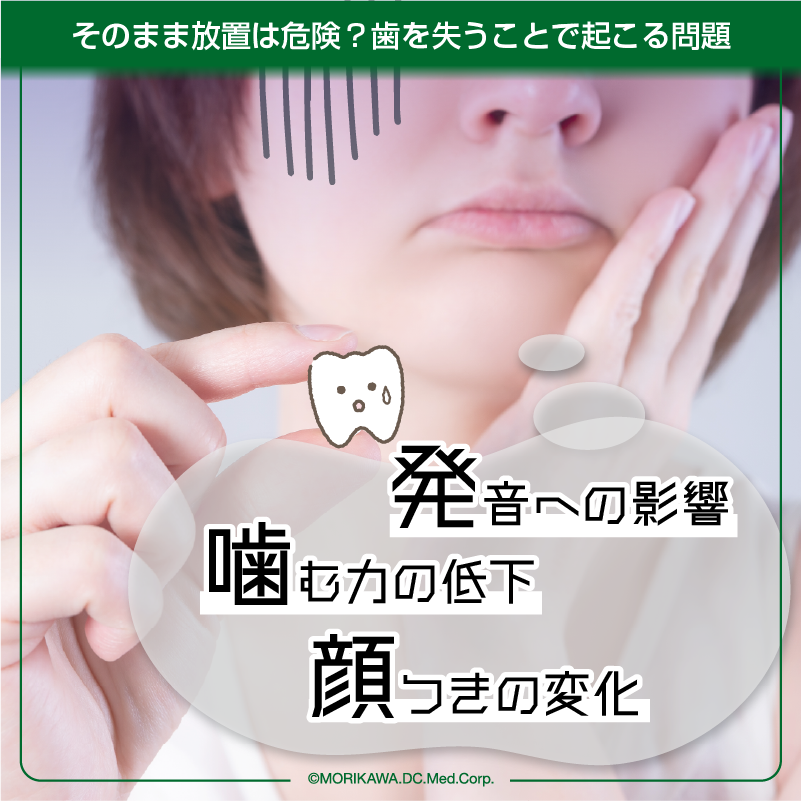 そのまま放置は危険？歯を失うことで起こる問題