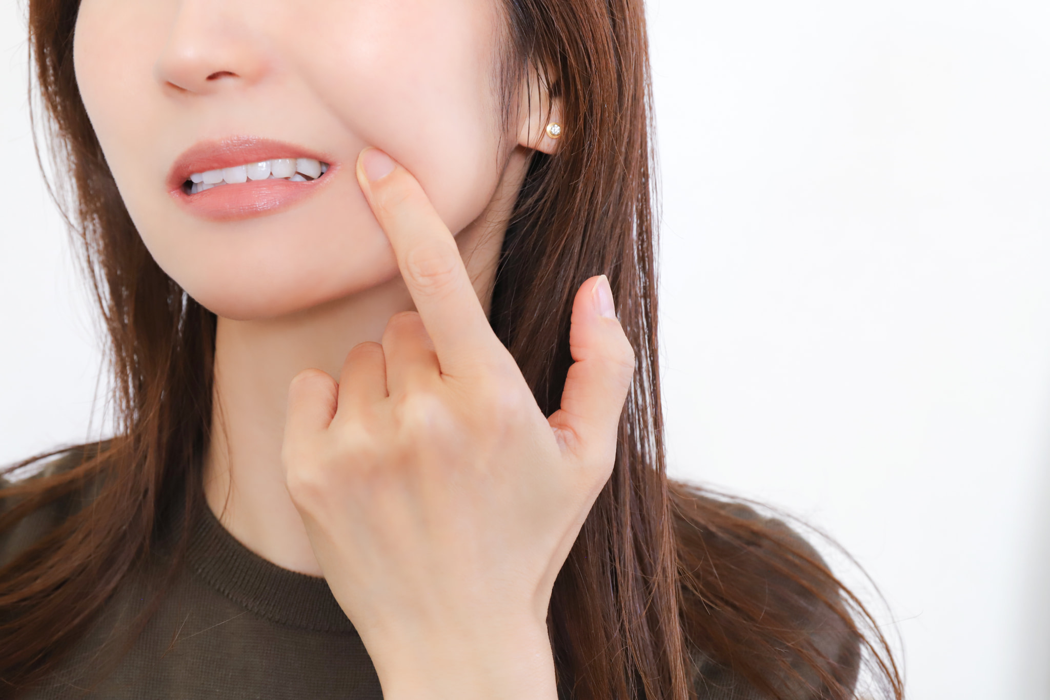 マウスピースの装着時間が短く歯列矯正が進まない女性