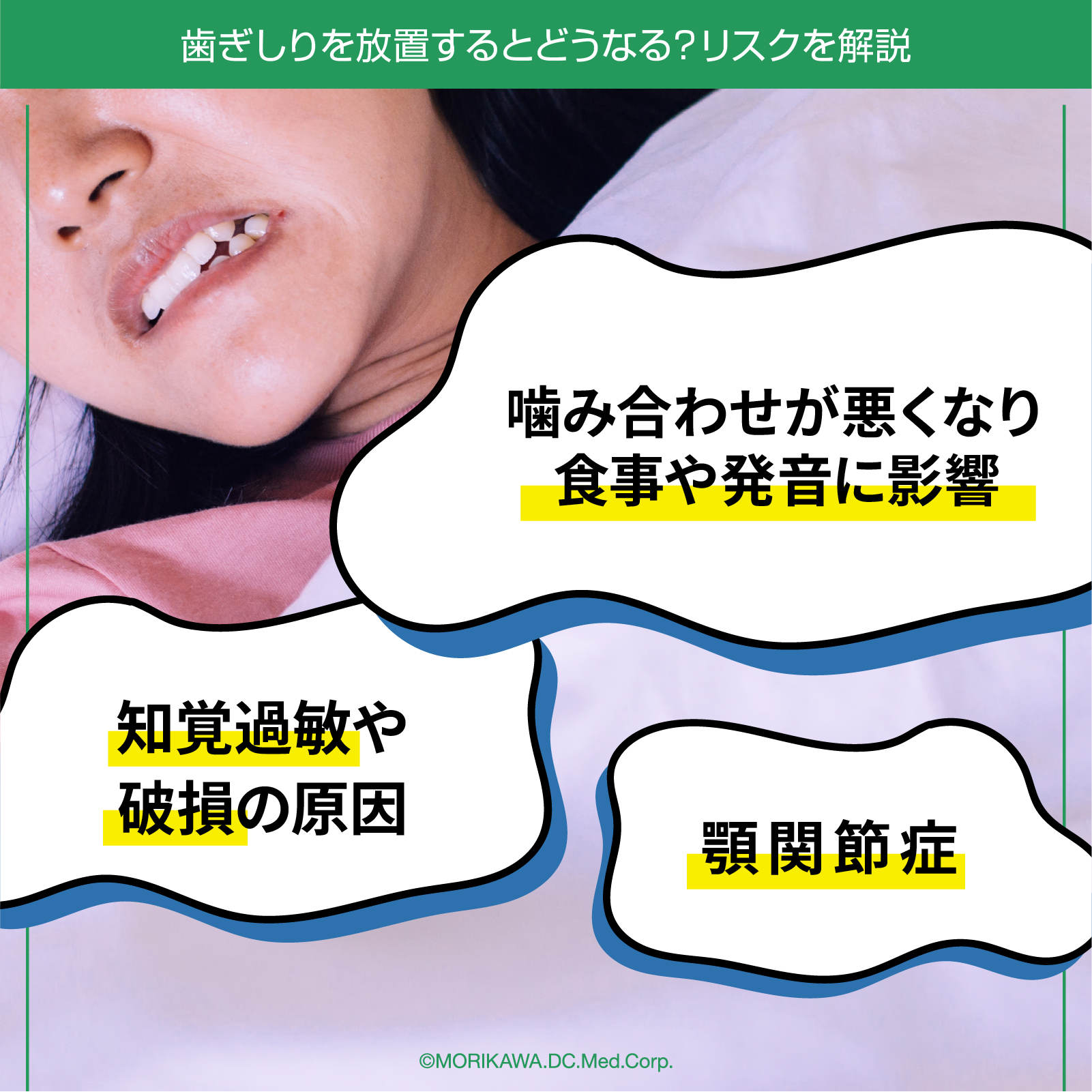 歯ぎしりを放置するとどうなる？リスクを解説