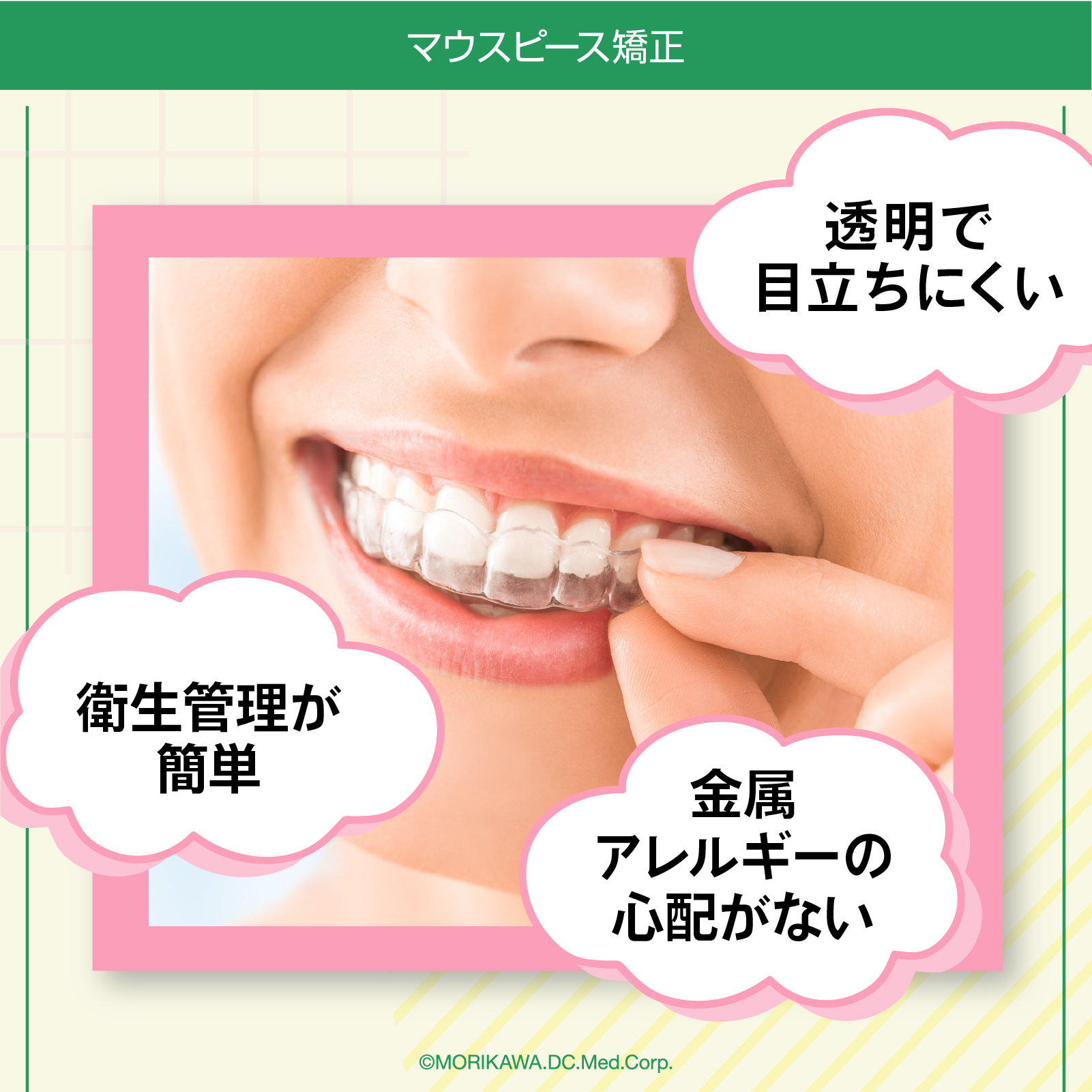 マウスピース矯正