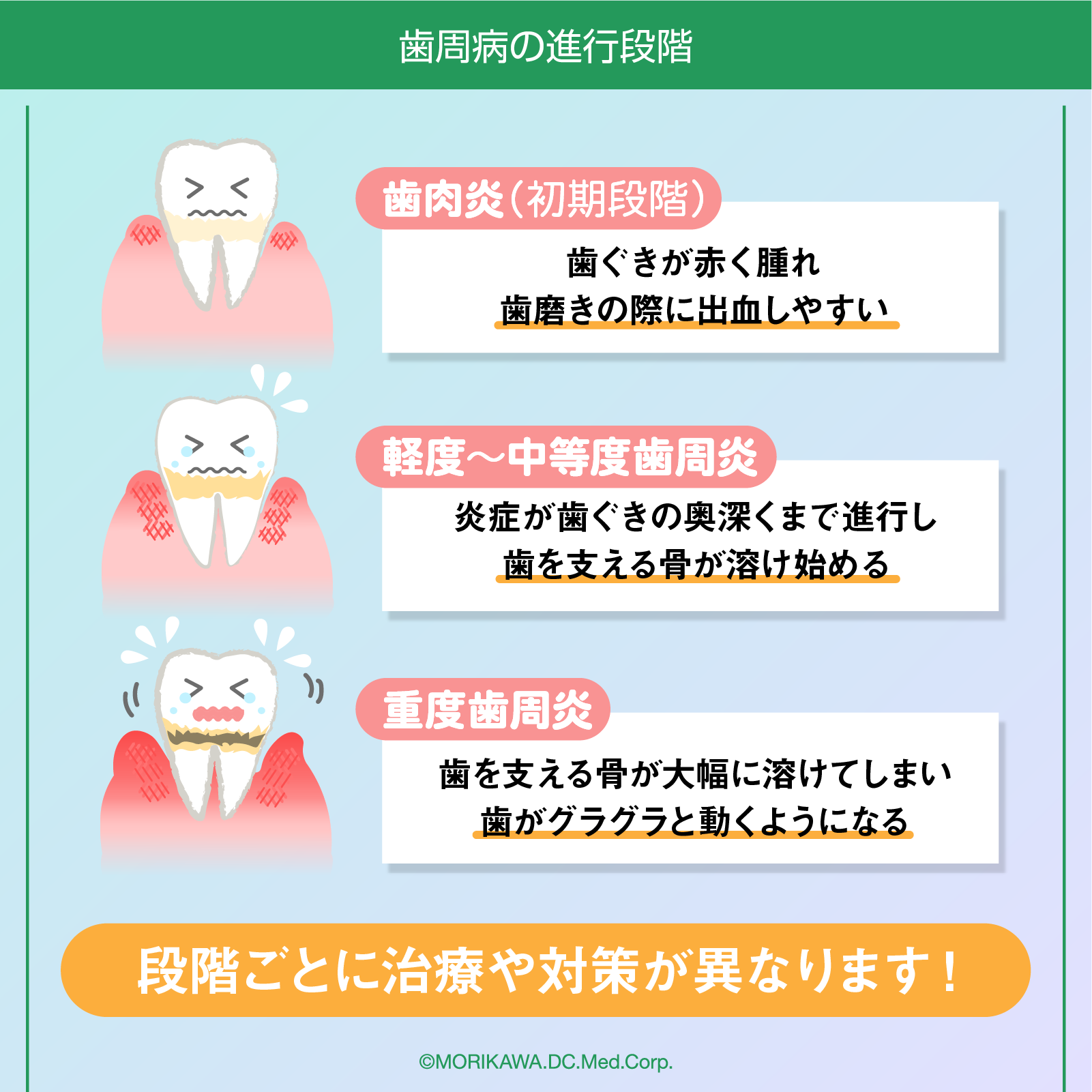 歯周病の進行段階