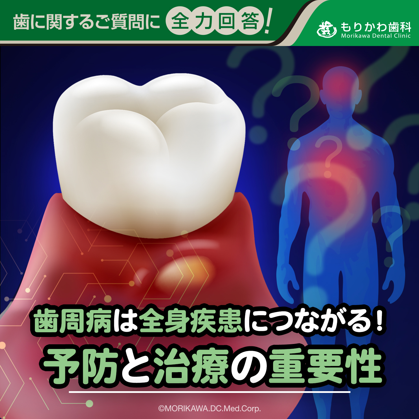 歯周病は全身疾患につながる！予防と治療の重要性
