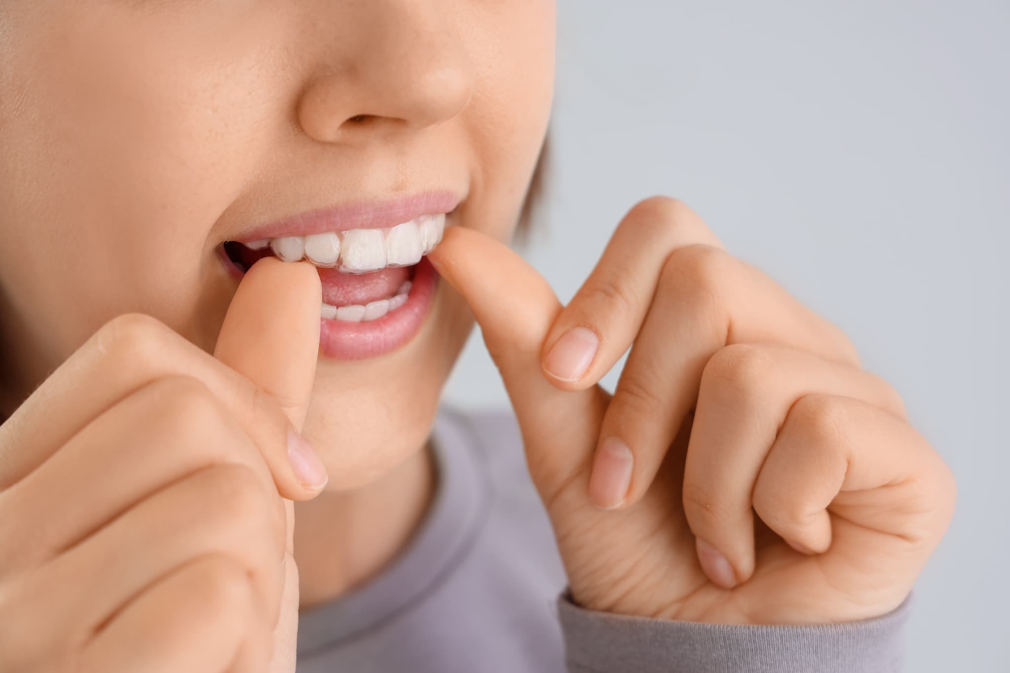 アライナーが浮かないように装着する女性