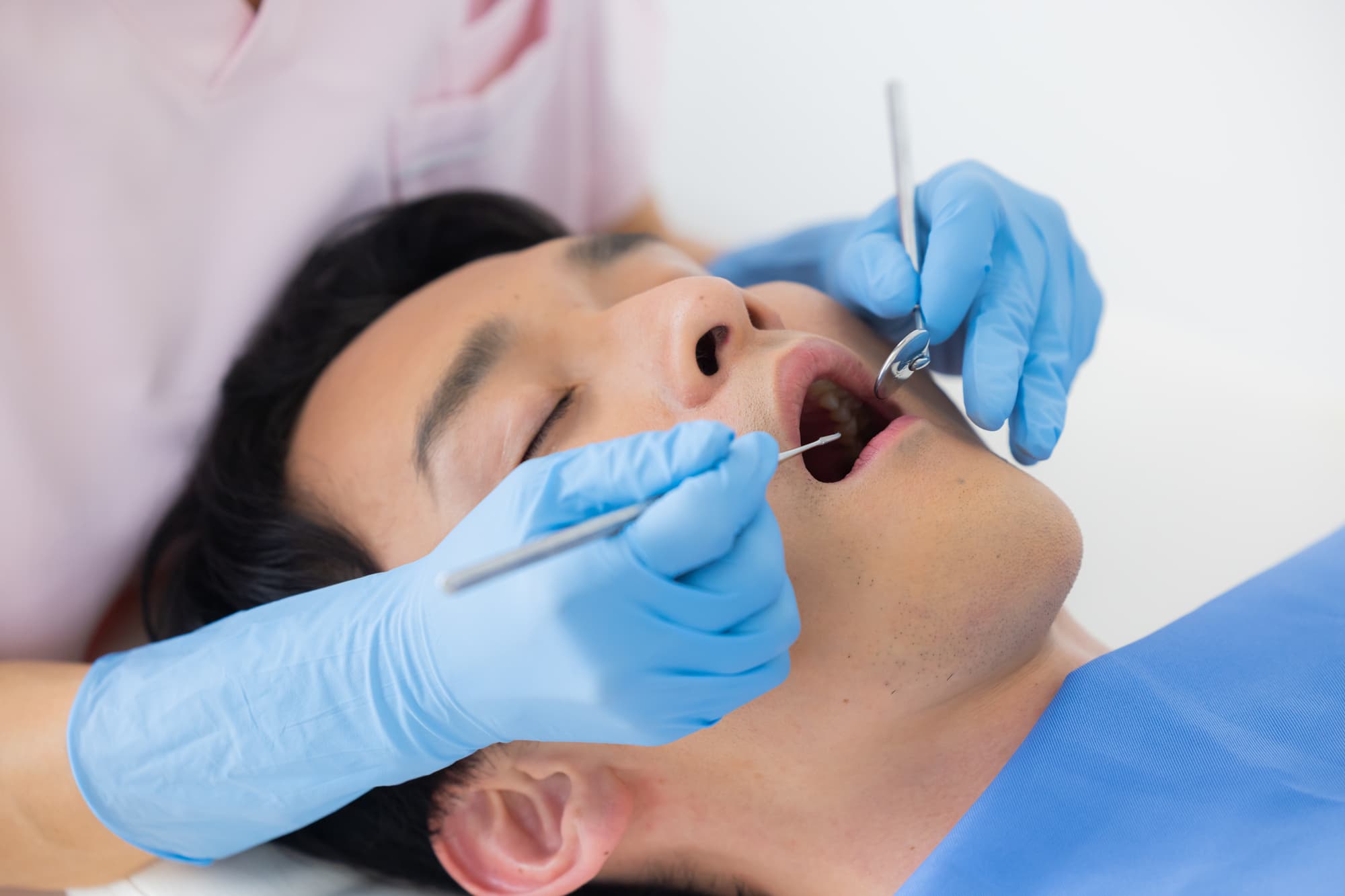 銀歯を白い歯に変える治療を受ける男性