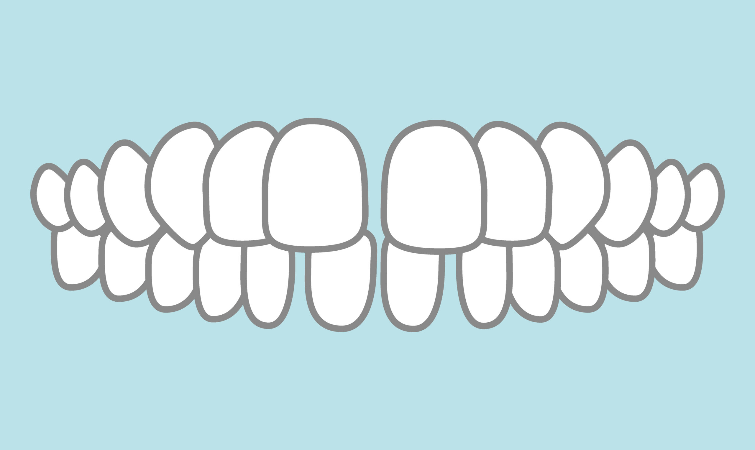 すきっ歯のイメージ