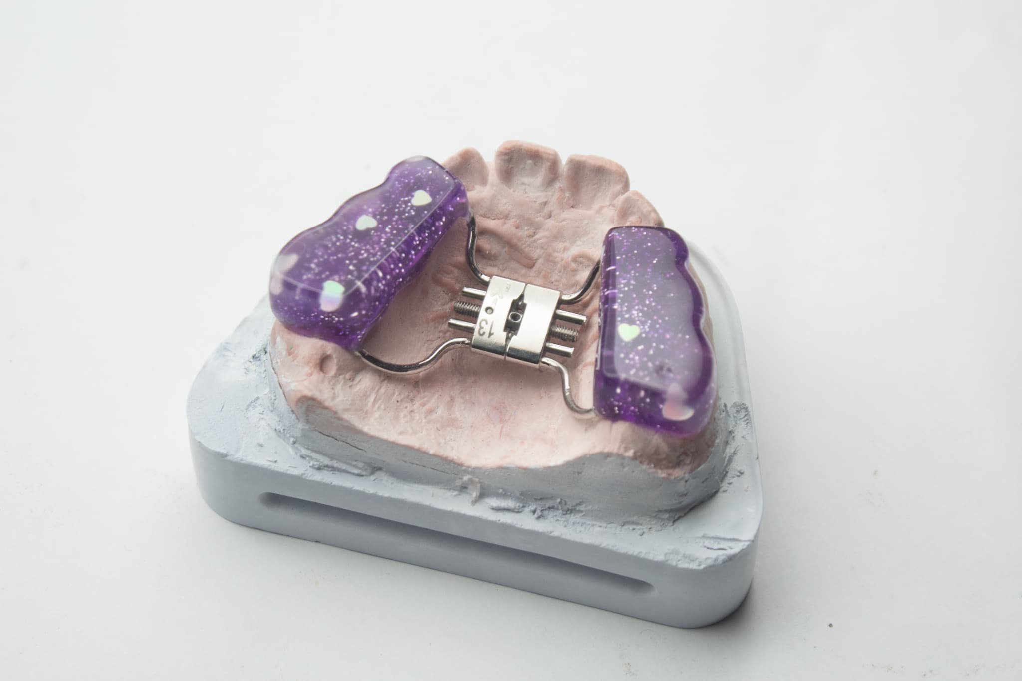 小児矯正で使用する急速拡大装置