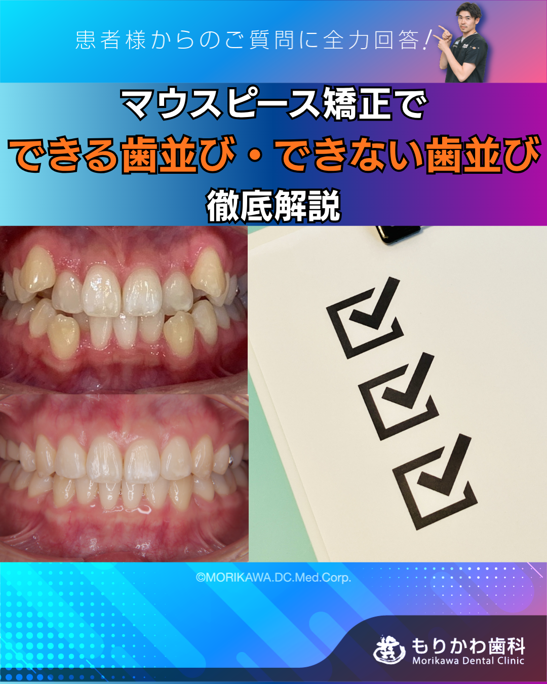 マウスピース矯正でできる歯並びと難しい歯並びを解説するもりかわ歯科のブログアイキャッチ画像